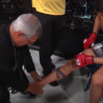 Brutal Leg Break Horror: Dylan Reischman’s Gruesome Debut Injury at Combate Global