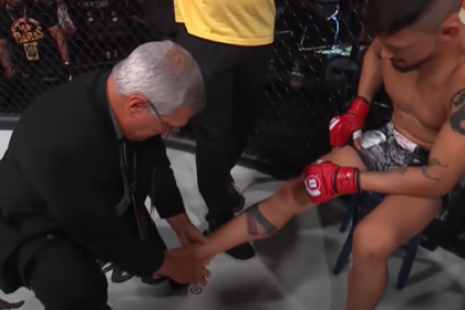 Brutal Leg Break Horror: Dylan Reischman’s Gruesome Debut Injury at Combate Global