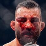 Doctor Halts Brutal UFC Paris Fight: Saint Denis’ Face Shattered by Moicano!