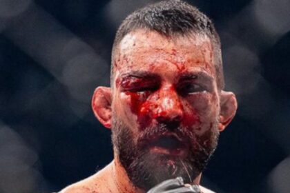 Doctor Halts Brutal UFC Paris Fight: Saint Denis’ Face Shattered by Moicano!