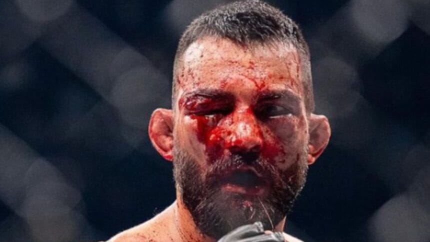 Doctor Halts Brutal UFC Paris Fight: Saint Denis’ Face Shattered by Moicano!